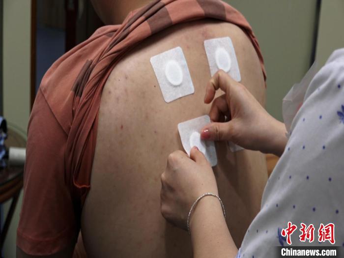 圖為醫(yī)生正在為民眾貼“三伏貼”?！√莆登?攝